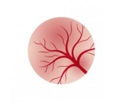 Inflammation of bladder mucosa and capsule treatment for women